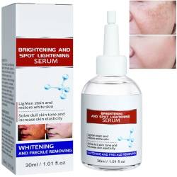 Aobenz Whitening and Freckle Removing Essence, Aobenz Spot Remover for Face, Aobenz Anti Spot Serum, Age Spot Sun Spots Dark Spot Correcting Serum (1Pcs) von JASUBAI